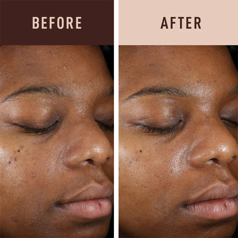 AMBI hydroquinone-free dark spot serum before and after photo showing reduced dark spots on brown skin