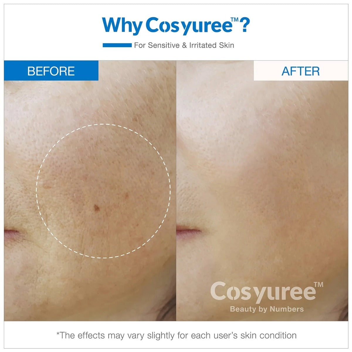 Hyaluronic Spicule Serum [120,000]