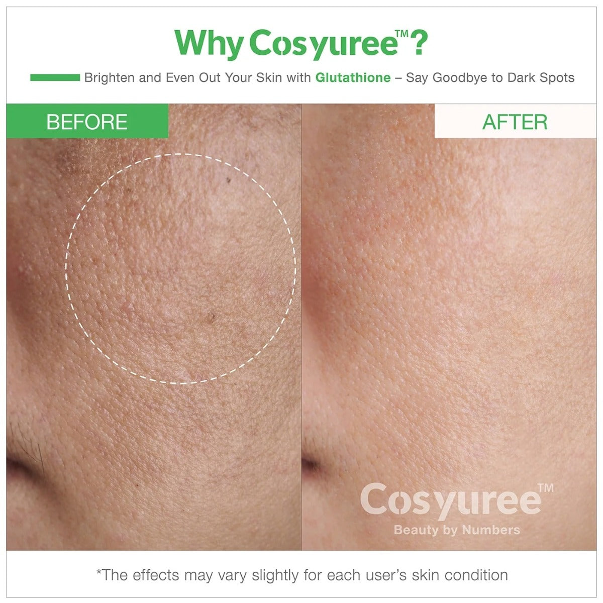 Glutathione Spicule Serum [1200,000]