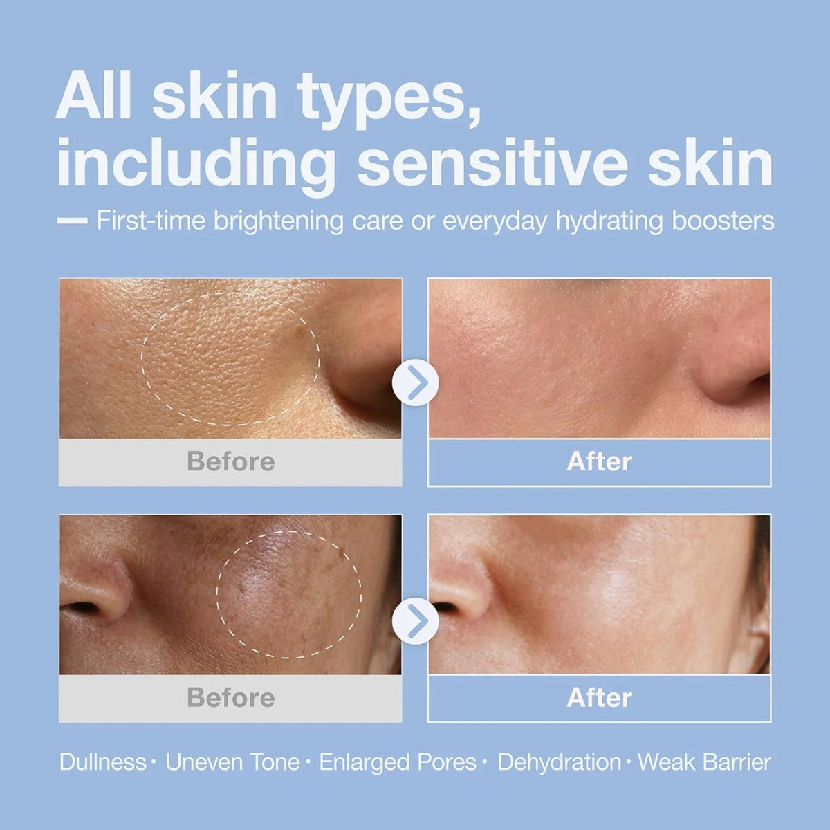 Niacinamide + Hyaluronic Acid Booster Serum