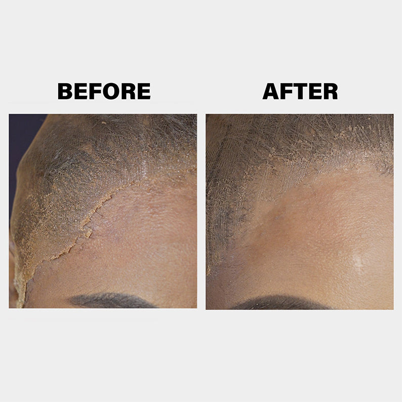 Before and after close-up showing effects of EBIN lace melt spray for wigs on lace front blending
